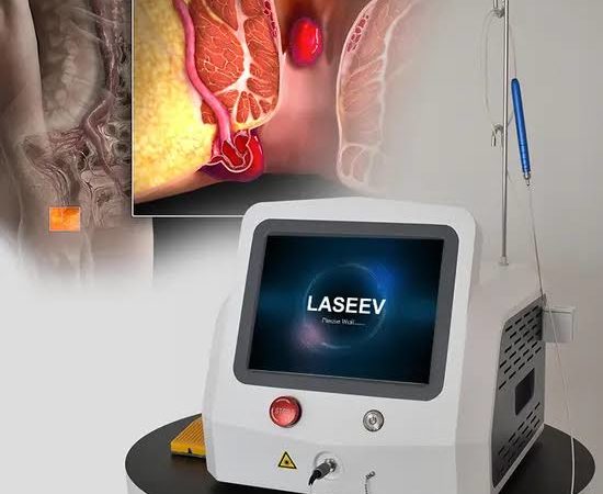 Quels critères faut-il vérifier avant de choisir un équipement de Laser proctologie pour son établissement ?