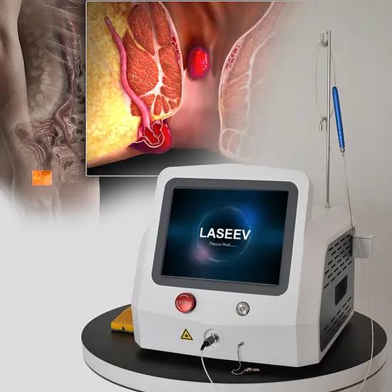 Quels critères faut-il vérifier avant de choisir un équipement de Laser proctologie pour son établissement ?